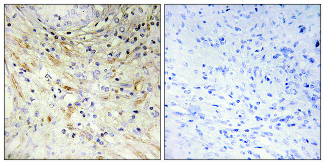 Anti-LAMB3 antibody produced in rabbit