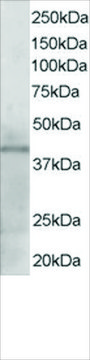 Anti-KLF3/BKLF antibody produced in goat
