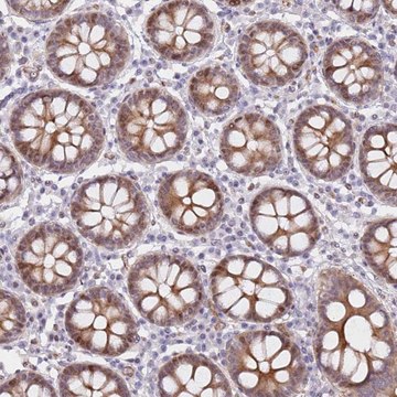 Anti-C10ORF11 antibody produced in rabbit