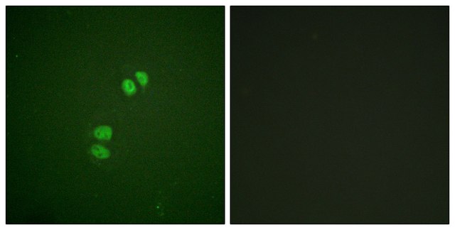 Anti-PLK1 antibody produced in rabbit