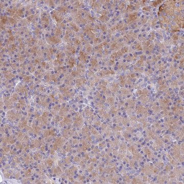 Anti-TYW1B antibody produced in rabbit