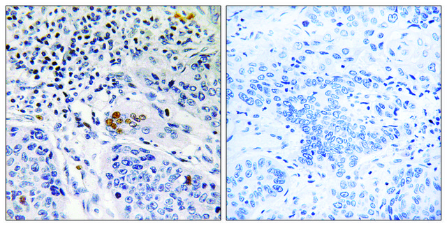 Anti-ZBTB40 antibody produced in rabbit