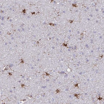 Anti-ASPH antibody produced in rabbit
