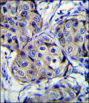 ANTI-CBLN2 (C-TERM) antibody produced in