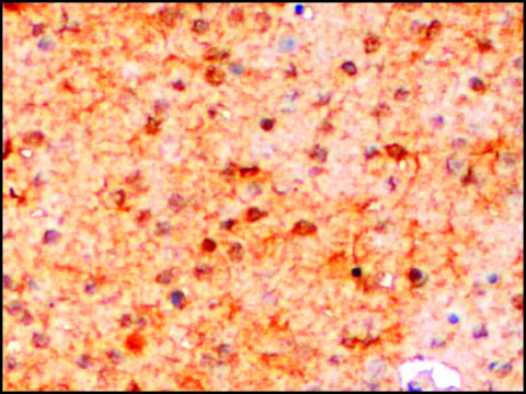 Anti-AIF1/IBA1 (Isoform 3) antibody produced
