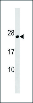 ANTI-PLLP (N-TERM) antibody produced in