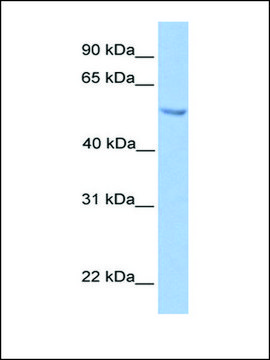 Anti-ETV5 antibody produced in rabbit