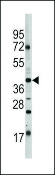 ANTI-OCT4 (OCT3) (E125) antibody produced