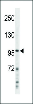 ANTI-NFKB(P100) (C-TERM S866/870) antibody produced
