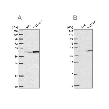 Anti-WDR18 antibody produced in rabbit