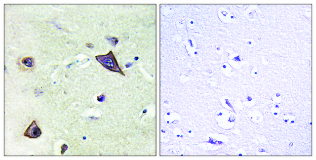 Anti-NMDAR1 antibody produced in rabbit
