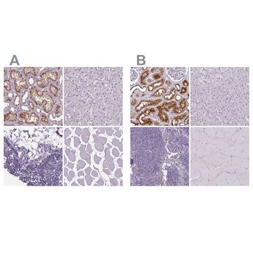 Anti-ATP6V1D antibody produced in rabbit
