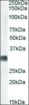 Anti-SRD5A2 (C-terminal) antibody produced in