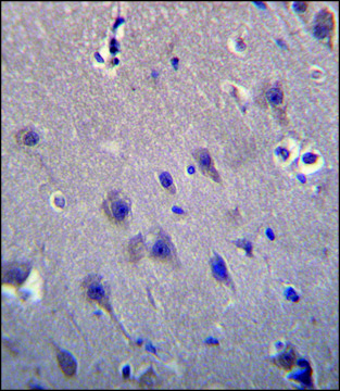 ANTI-MCF2 (C-TERM) antibody produced in