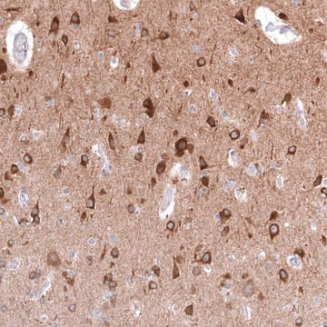 Anti-TTYH3 antibody produced in rabbit