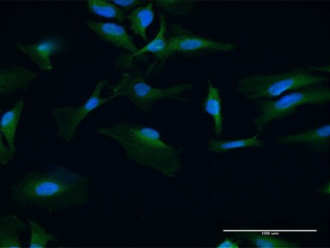 Anti-UBADC1 antibody produced in mouse