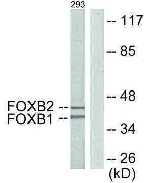 Anti-FOXB1 antibody produced in rabbit