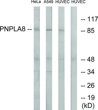 Anti-PNPLA8 antibody produced in rabbit