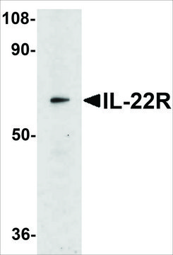 Anti-IL-22 Receptor antibody produced in