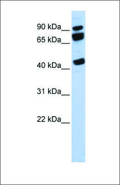 Anti-DDX17 antibody produced in rabbit