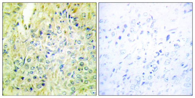 Anti-DLEC1 antibody produced in rabbit