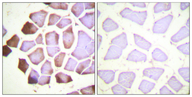 Anti-Tnni3, N-Terminal antibody produced in