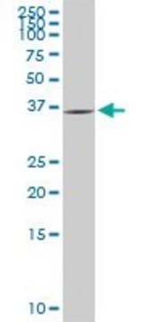 Monoclonal Anti-GYG1, (N-terminal) antibody produced