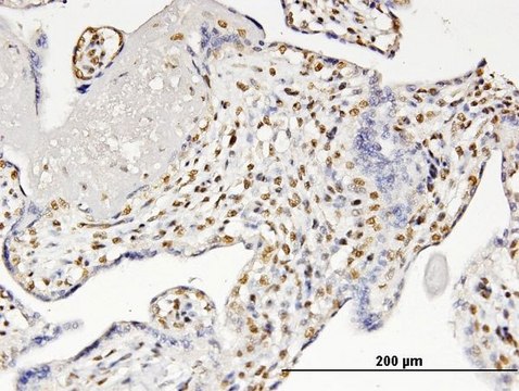 ANTI-RUNX2 antibody produced in mouse