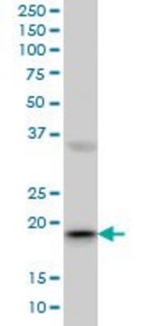 Monoclonal Anti-RBBP9, (C-terminal) antibody produced