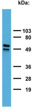 Monoclonal Anti-Cytokeratin 7/17 antibody produced