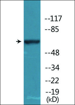 Anti-phospho-WEE1 (pSer??²) antibody produced in