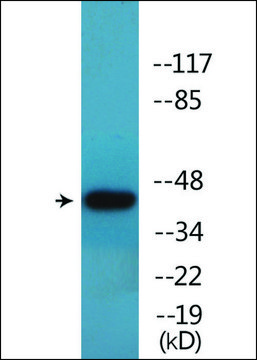 Anti-phospho-p53 (pSer??) antibody produced in