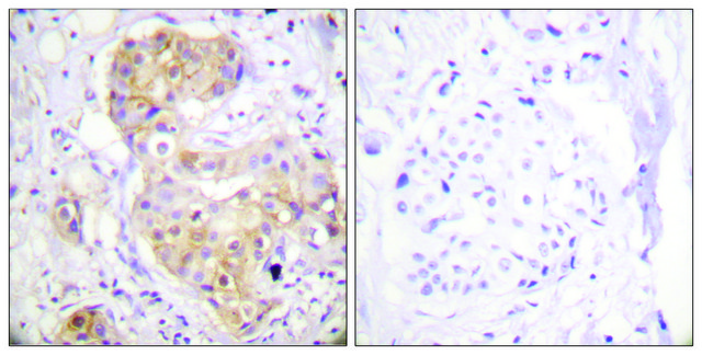 Anti-PKC ? antibody produced in