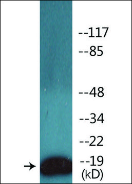 Anti-phospho-CD3 ? (pTyr¹?²) antibody produced
