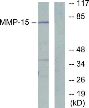 Anti-MMP-15 antibody produced in rabbit
