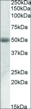 Anti-ACPP antibody produced in goat