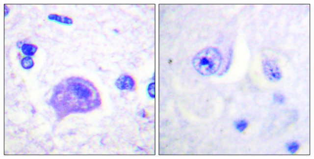 Anti-HRS antibody produced in rabbit