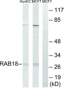 Anti-RAB18 antibody produced in rabbit