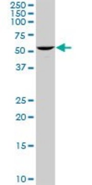 Anti-UCKL1 antibody produced in rabbit