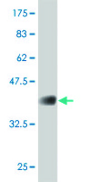 ANTI-FOXO1A antibody produced in mouse