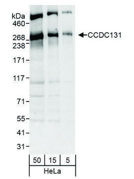 Rabbit anti-CCDC131 Antibody, Affinity Purified