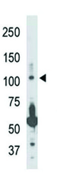 ANTI-NIK (CENTER) antibody produced in
