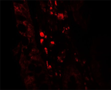 Anti-GLIPR1 antibody produced in rabbit
