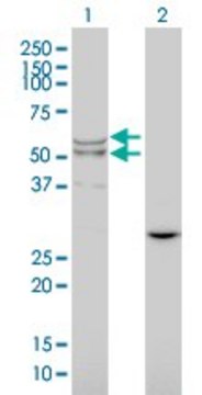 Monoclonal Anti-LIPA antibody produced in