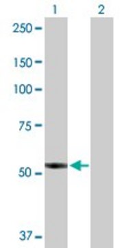 Anti-PTGIS antibody produced in rabbit