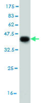 Monoclonal Anti-DFNB31 antibody produced in