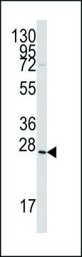 ANTI-GREMLIN (C-TERM) antibody produced in
