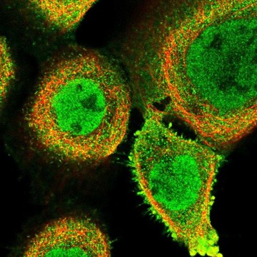 Anti-FAM189B antibody produced in rabbit