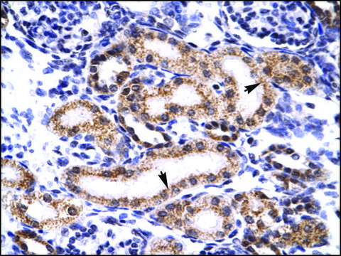 Anti-TRIM3 antibody produced in rabbit
