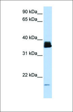 Anti-PPIA antibody produced in rabbit
